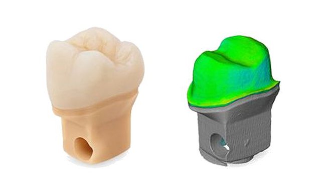 Imágenes Digitales: CORONAS CAD-CAM